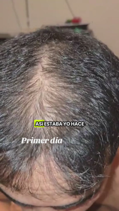 OUHOE -CRECIMIENTO DE CABELLO LIMA