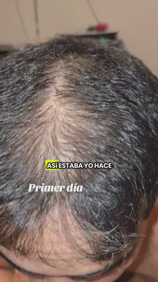 OUHOE -CRECIMIENTO DE CABELLO LIMA